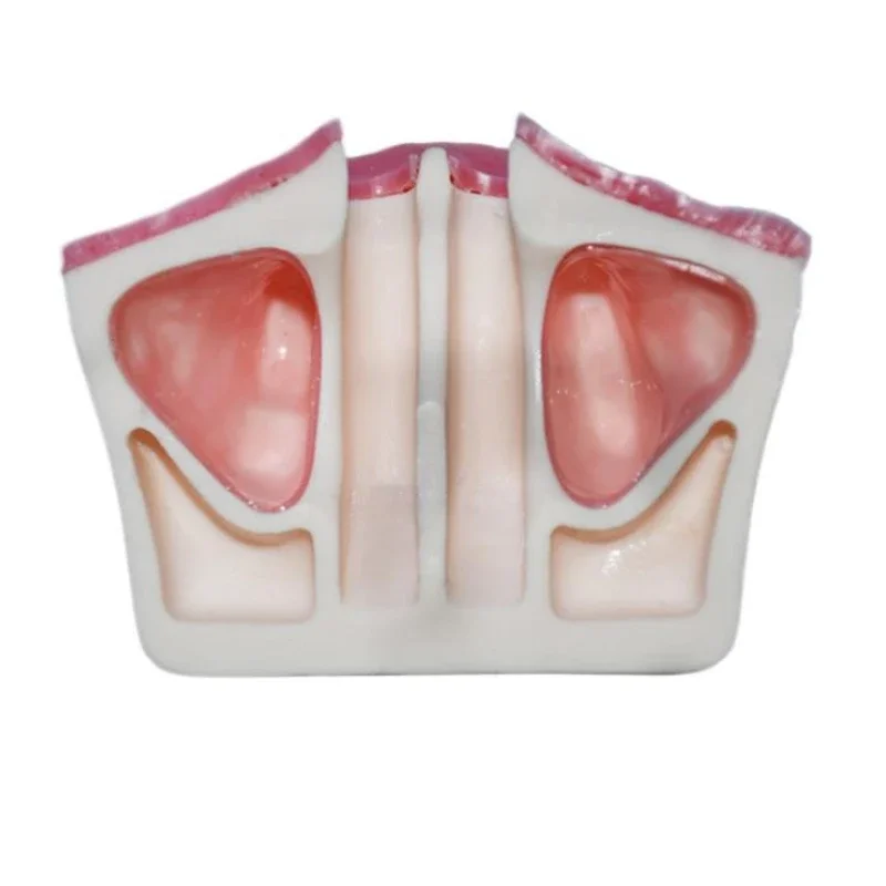 2Pcs Dental Maxillary Sinus Lift Implant Model Missing Teeth Soft Gum Model For Dental Students Practice Training Teaching Tools