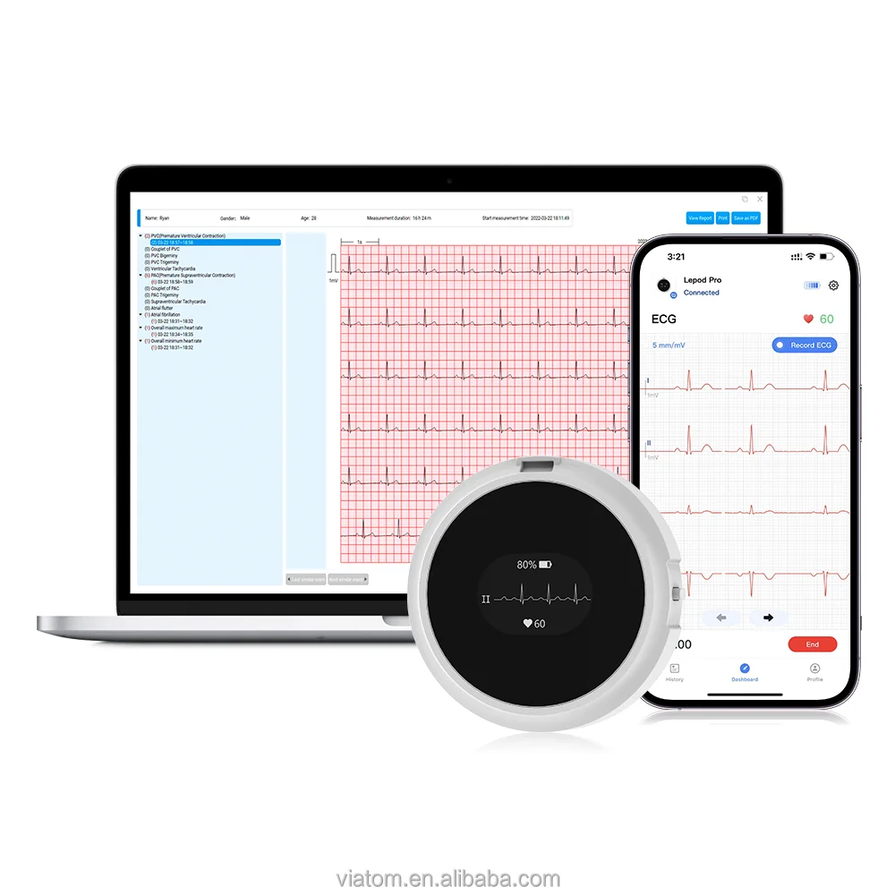 Viatom Lepod Pro Professional Medical Grade 12 Lead  Portable 24 Hour  Recording Holter  Mon itor