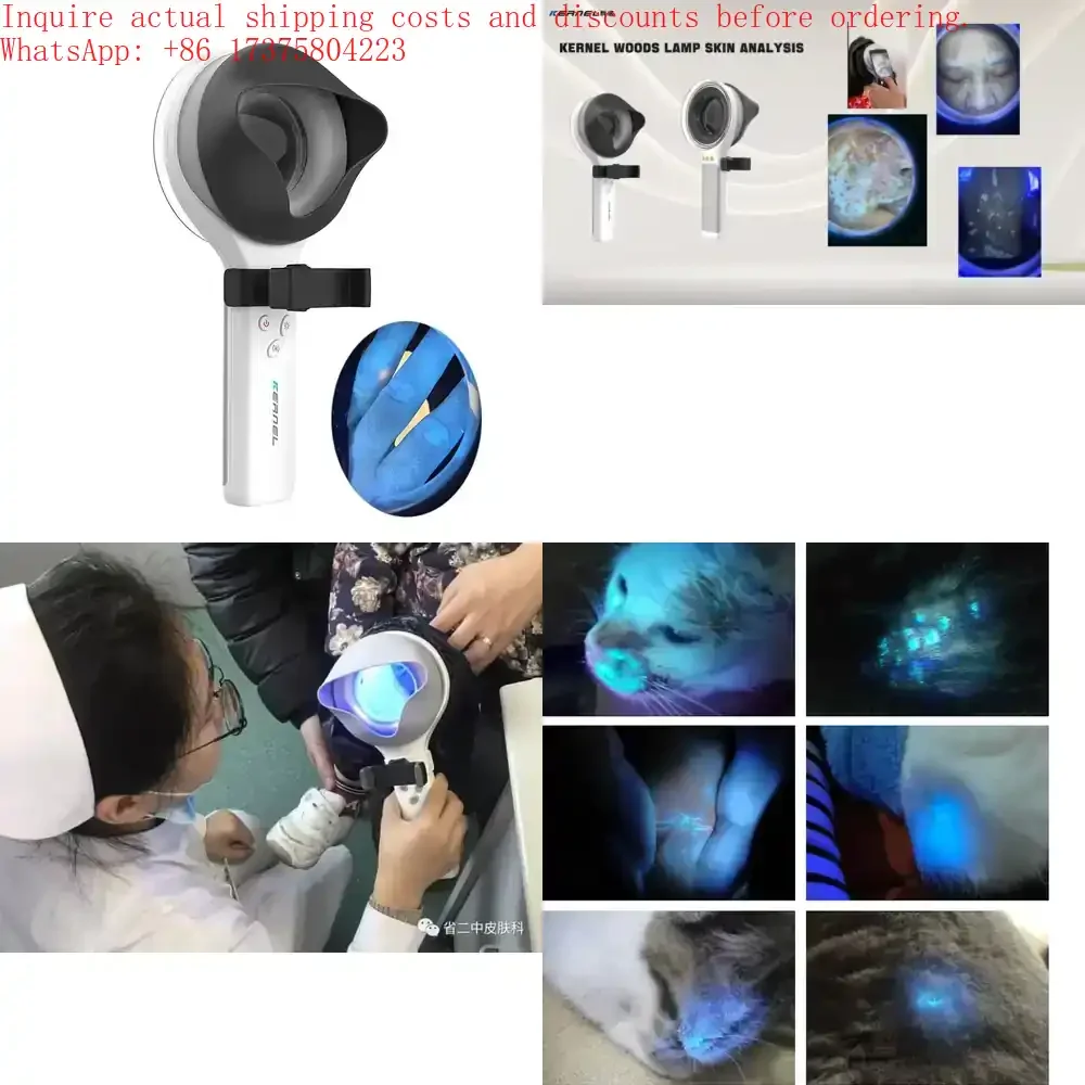 

Facial Analysis Machine Kernel KN 9000B Portable Medical Woods Lamp Analysis for Disease test