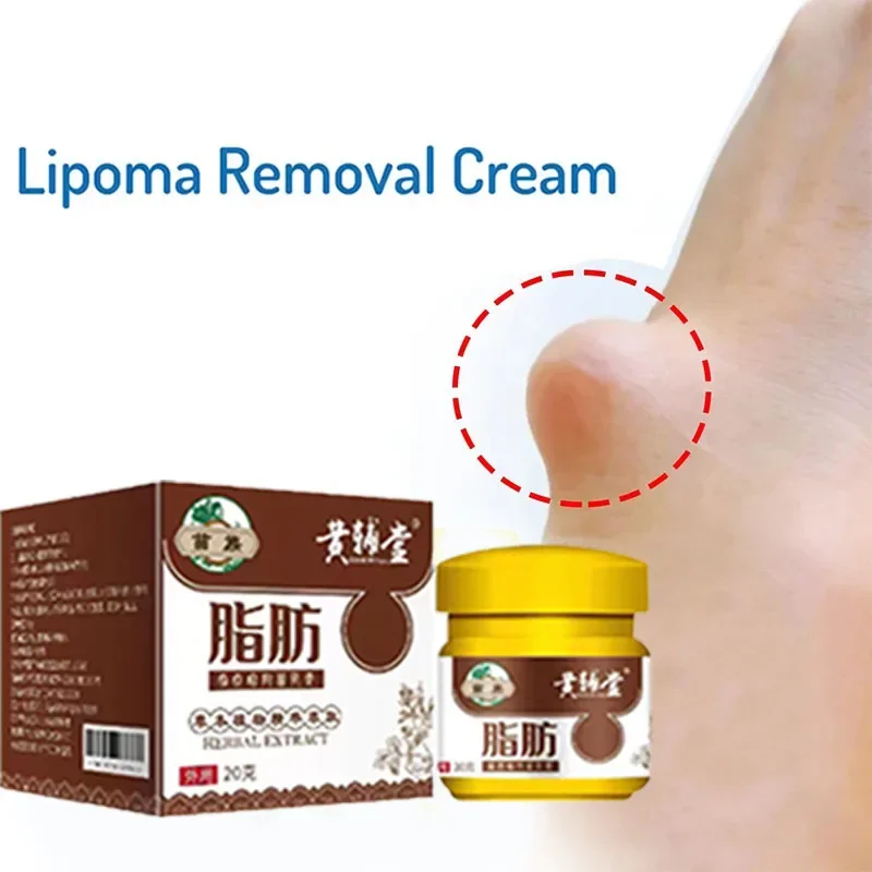 Crema calmante para eliminación de lipomas, alivio del dolor de forma segura, crema subcutánea para eliminar grumos de grasa, celulitis