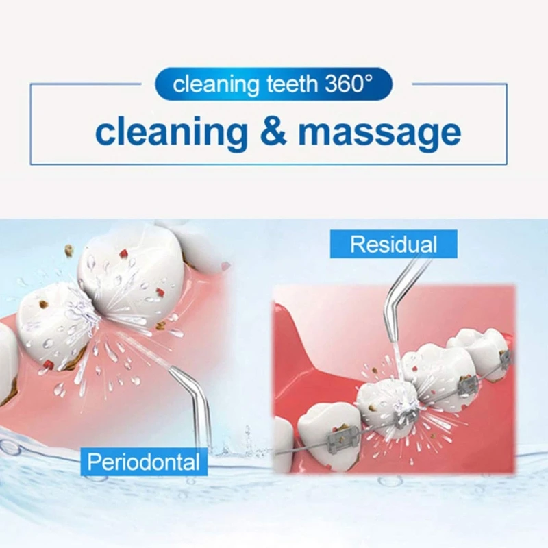 

High-Pressure Water Flossers Jet Tip Replacement Tips Refills for Head for Oral Irrigator & Dental Flossers Orthodontic