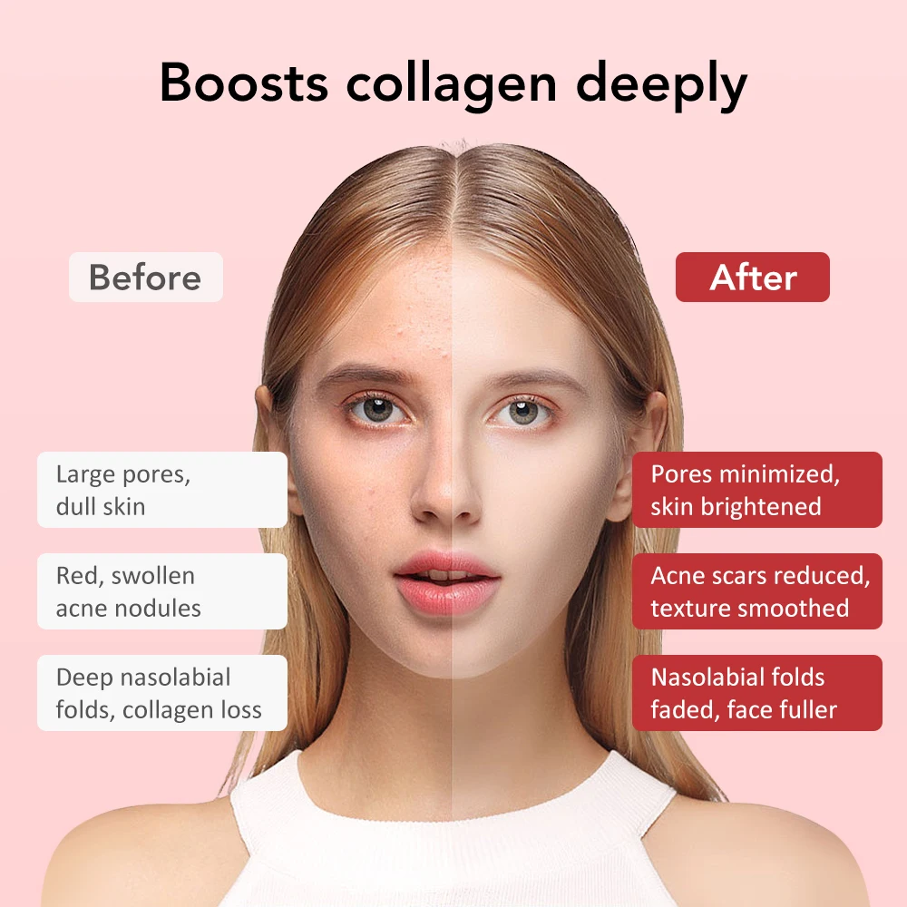 Dispositivo eléctrico de masaje Facial multifuncional para el cuidado de la piel, masajeador de vibración de belleza, limpieza Facial, rejuvenecimiento de la piel, estiramiento y estiramiento