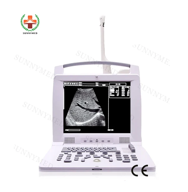 

SY-A005 Simple Portable Animal Vet Ultrasound Scanner Price for Sale