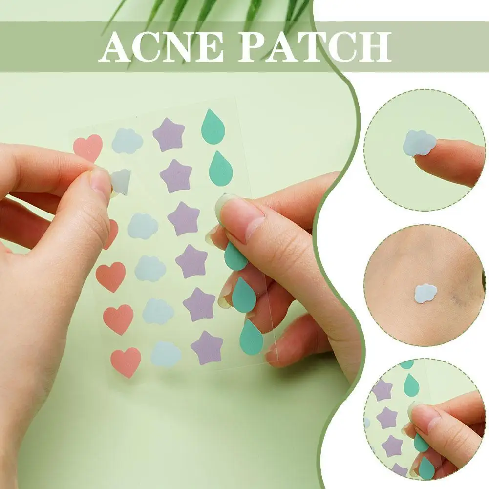 Patch anti-acné coloré et invisible, autocollants de soins de la peau, correcteur d'originalité, outil de maquillage de beauté pour le visage