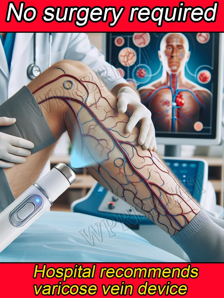 

Device to remove varicose veins and eliminate spider legs phenomenon