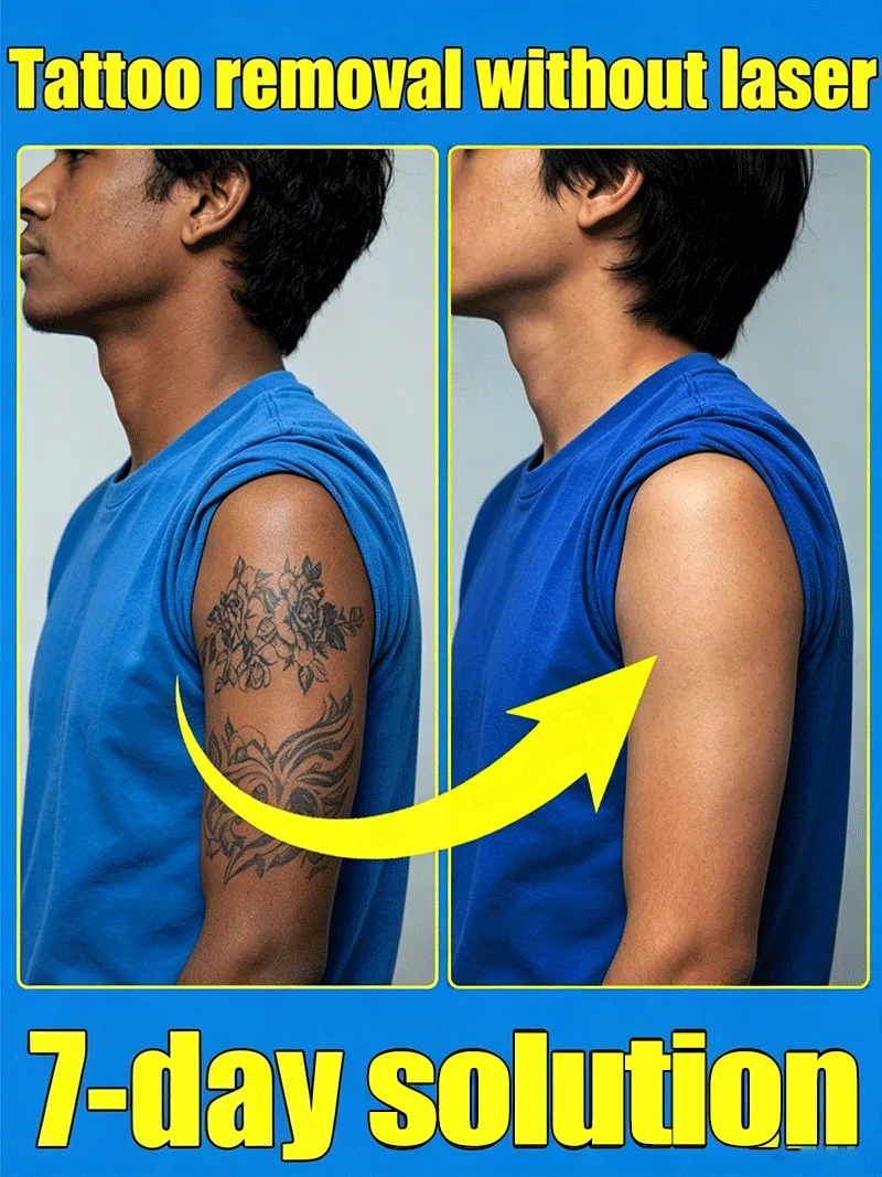 

Rapid Clean Up Embroidery Tattoo Color Removal