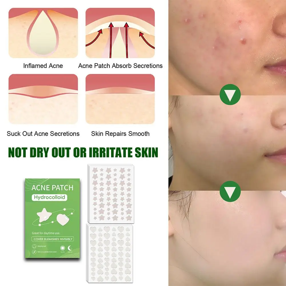 Colorful Star&Heart Pimple Patch Acne Colorful Invisible Acne Removal Skin Care Stickers Concealer Face Spot Care Patch