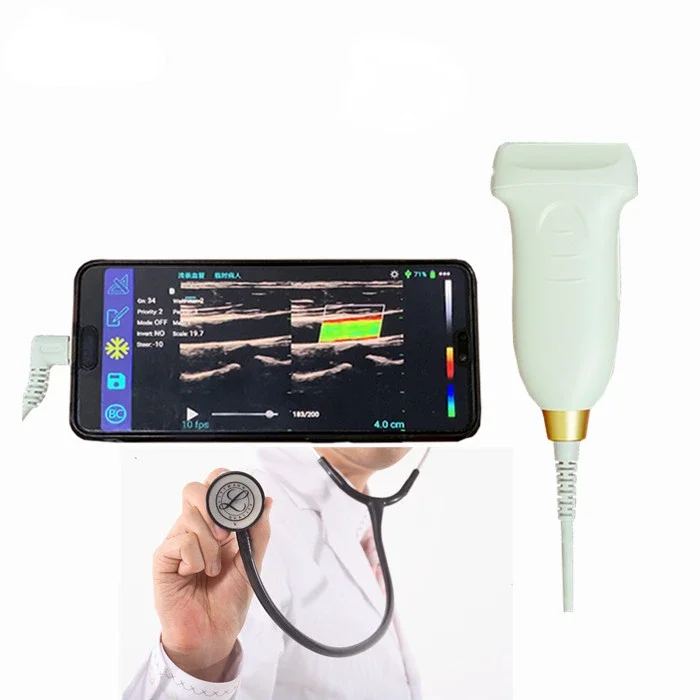 ecograph ultrasound echo scanner Ultrasound probe for Android color Doppler USB wireless Linear Probe