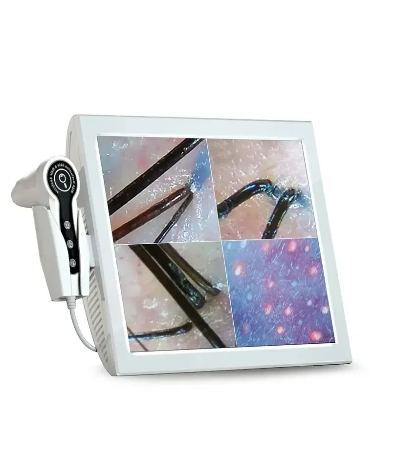 15 Inch Digital HD Screen Home Use  and Hair Analyzer Help You Analysis Of And Analysis Scanner  Fixed