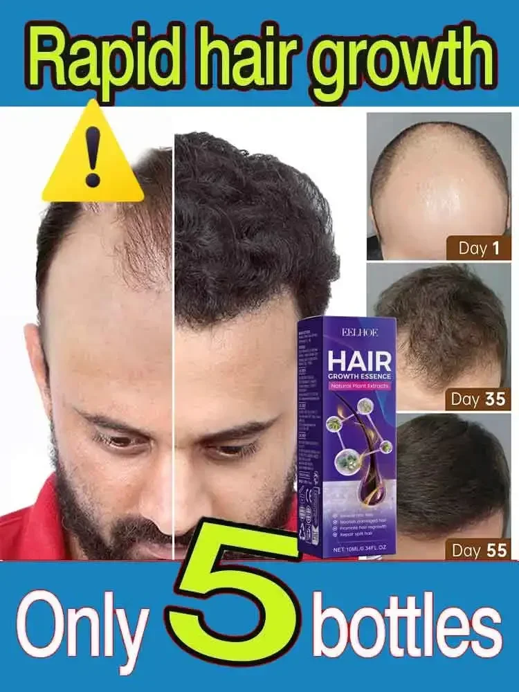 

98% of buyers buy again, have more and more hair, say goodbye to baldness, thick hair,Hot selling product