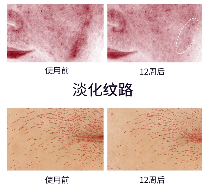 Free Shipping Photon Beauty Milk Light Skin Rejuvenation Brightening Household