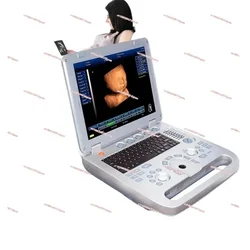 High quality 3d ultrasound machine medical scan digital pseudo color usg 4d optional ecography