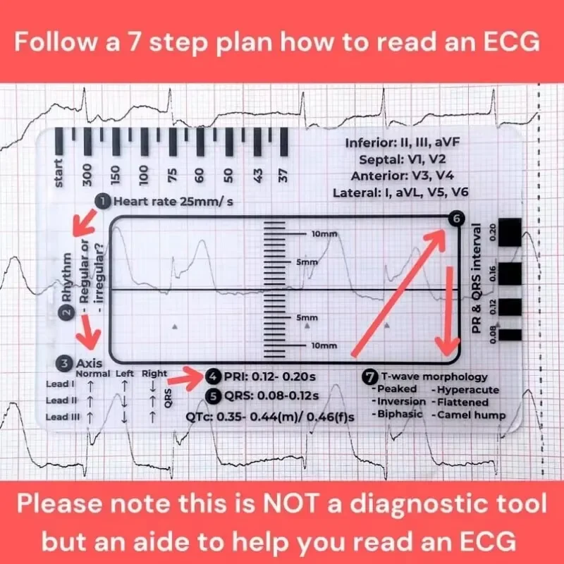 ECG 7 Step Ruler  Portable Heartbeat Ecg Observation 7-Step Scale Measurement Tool Ruler for Ecg Interpretation