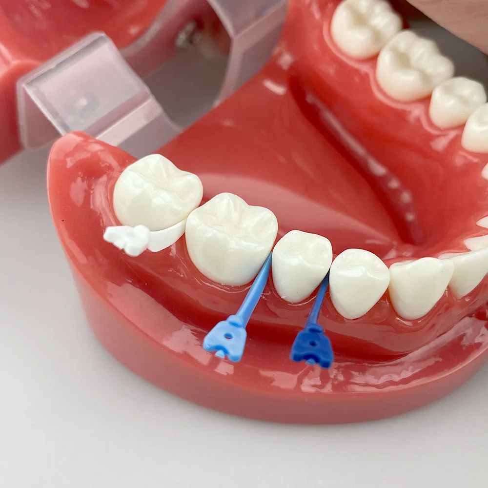 Dental Wedges for Sectional Matrix System Refill Wedge Disposable Plastic Tulwar Wedges with Hole Dental Products