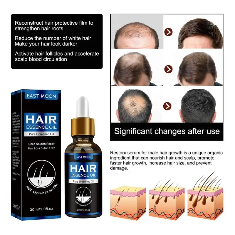 Soro eficaz do regrowth do cabelo para homens e mulheres, Produto do crescimento do cabelo, Fast Grow, Prevenir a calvície, Tratamento da alopecia