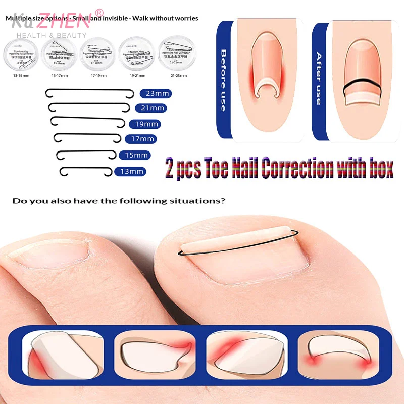 2Pcs Ingrown Toenai…