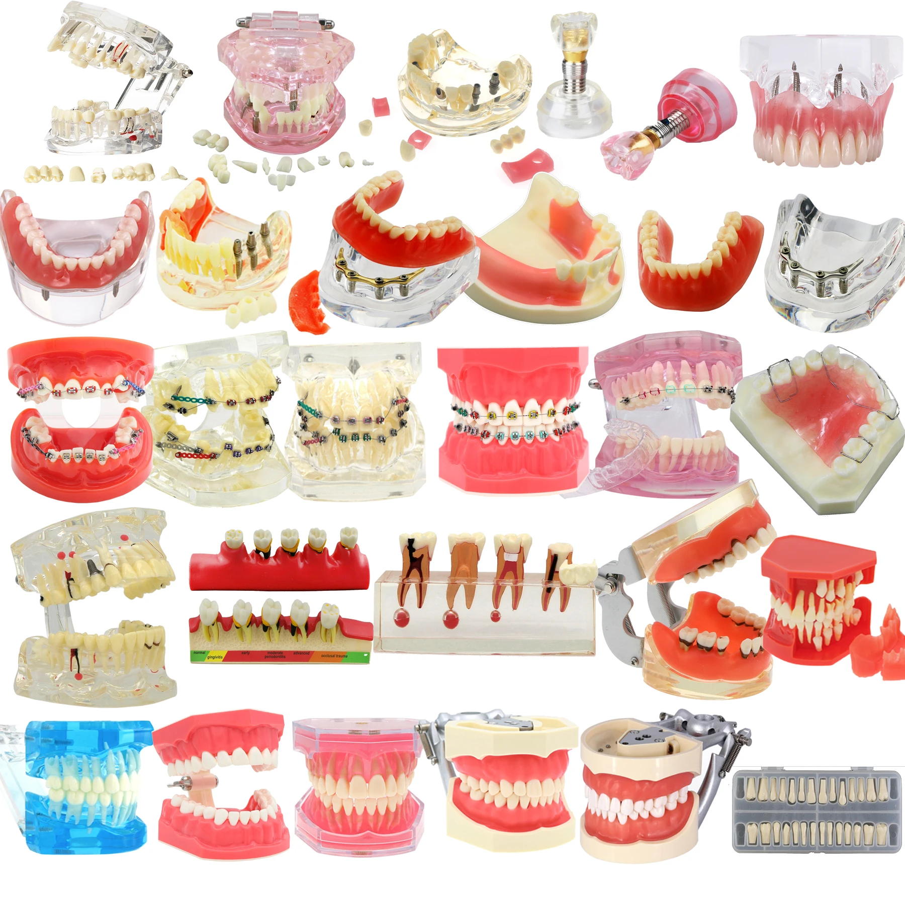 Modèle de dents dentaires, fuchsia, implants standard, orthodontique, dentiste, démonstration, étude