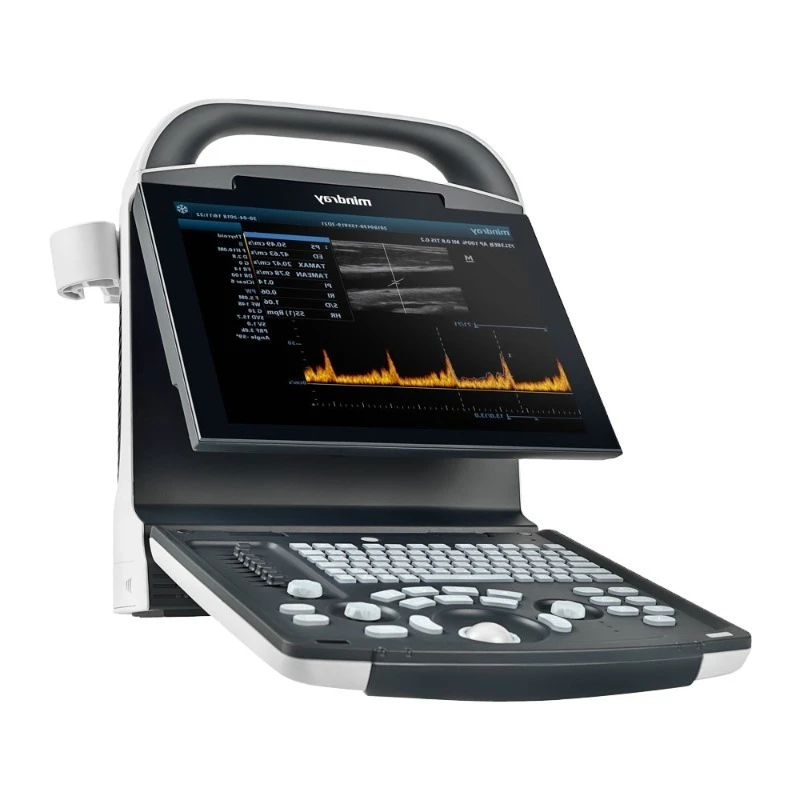 2026 Affordable DP-10 Portable Ultrasound Scanner Slightly Used Medical Device for Animal Care and Supplies