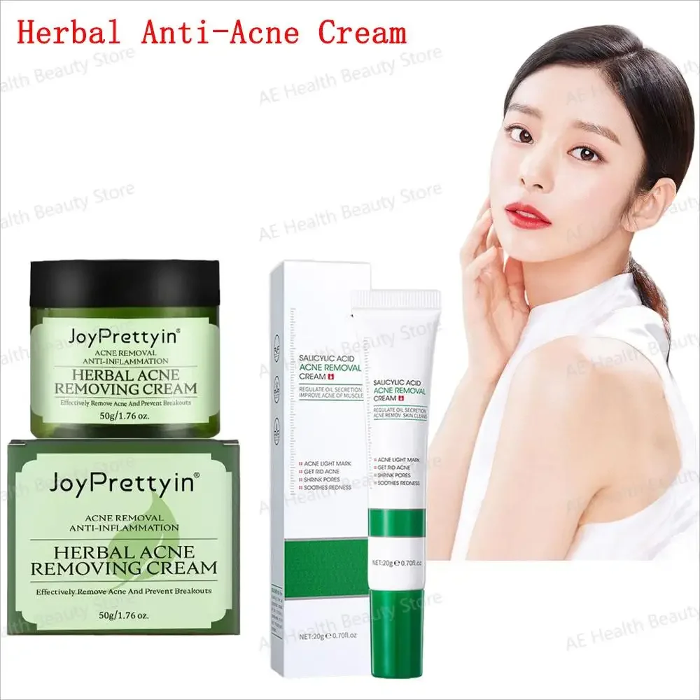 

Herbal Anti-Acne Cream Natural Plant Formula Improves Water And Oil Balance Tighten Pore Smoothing Brightening Facial Skin Cream