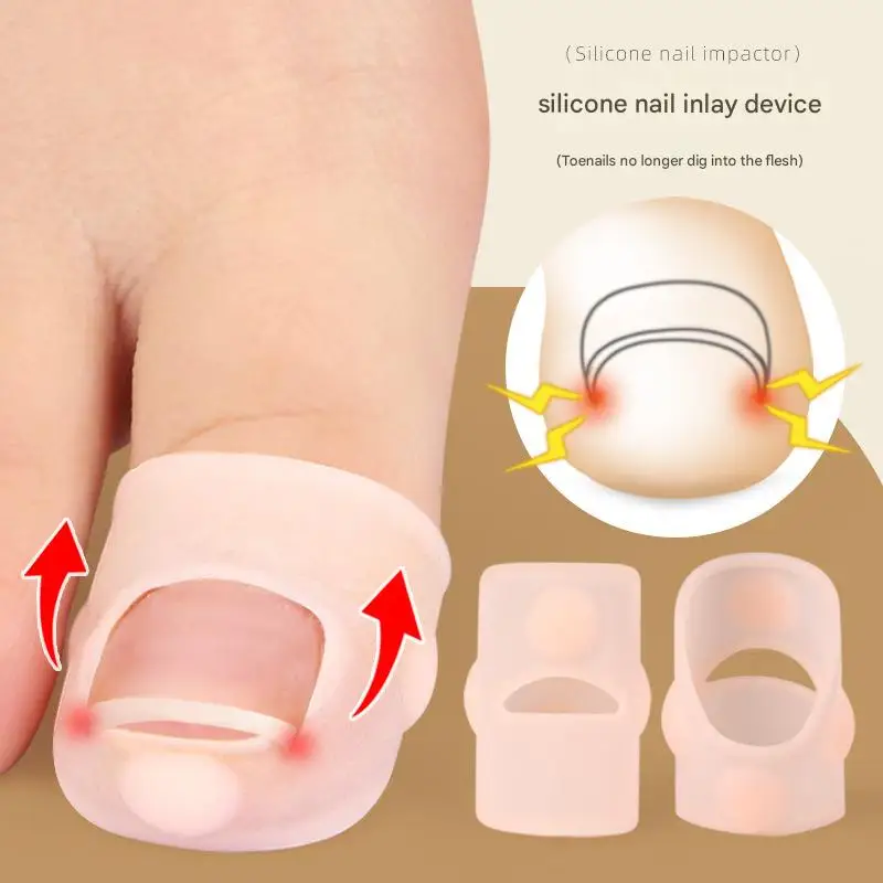 

Silicone Ingrown Toenail Correction Tool Nail Straightening Protector Durable reusable under tension Tools Foot Care Tools