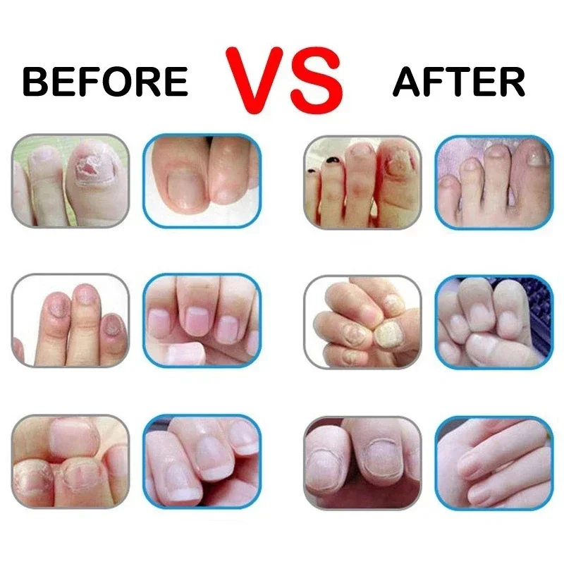 Huile nutritionnelle pour ongles, huile pour cuticules, nutritif séché et hydratant, soin des ongles, réparation, liquide endommagé, outil de conception pour Nail Art, 6 pièces