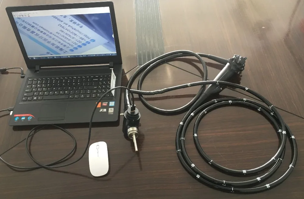 Medical Flexible USB Endoscope Portable Video Gastroscope /Upper Gastrointestinal Endoscopy