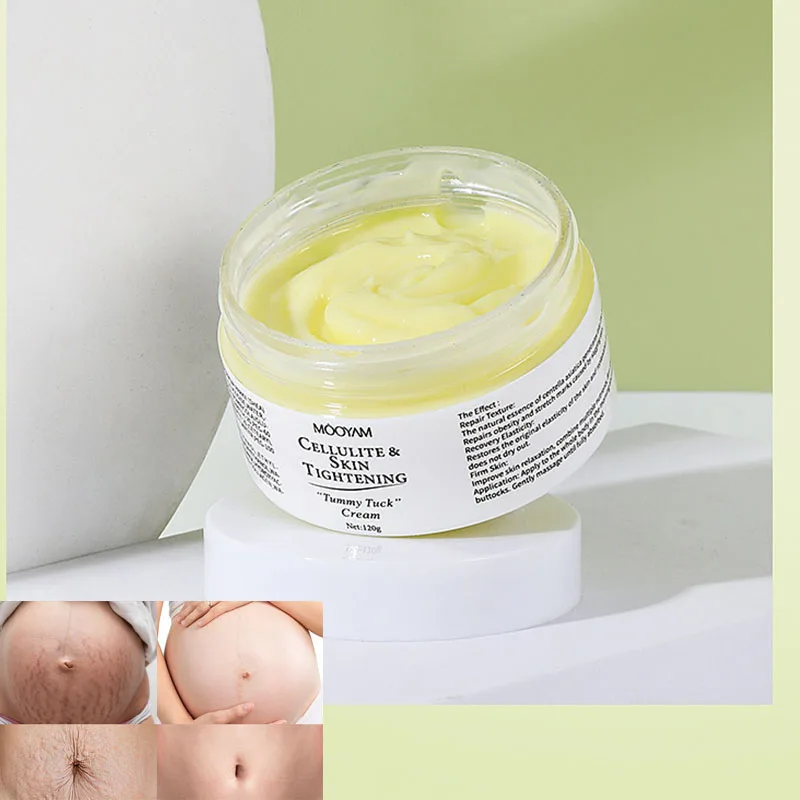 

Stretch Mark Cream Fat Body Pattern Care Cream Firming Nourishing Fading Postpartum Pregnancy Pattern Repair Cream Skincare
