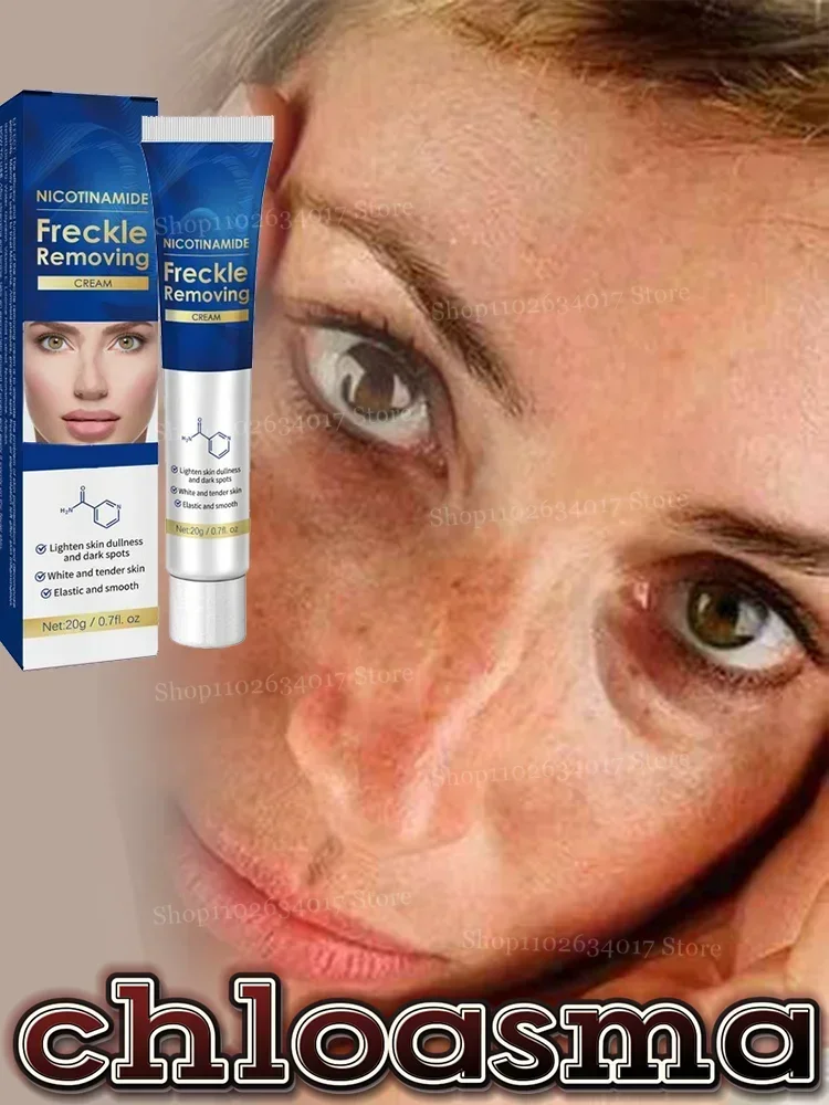 38Skincare Deep clear spots, skin rejuvenation - natural ingredients freckle cream, goodbye spots trouble