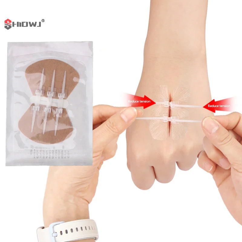 Zipper Band-aid Painless Wound Closure Device Suture-free Wound Dressing Patches Zip Suture Reducer Elastic Bandage