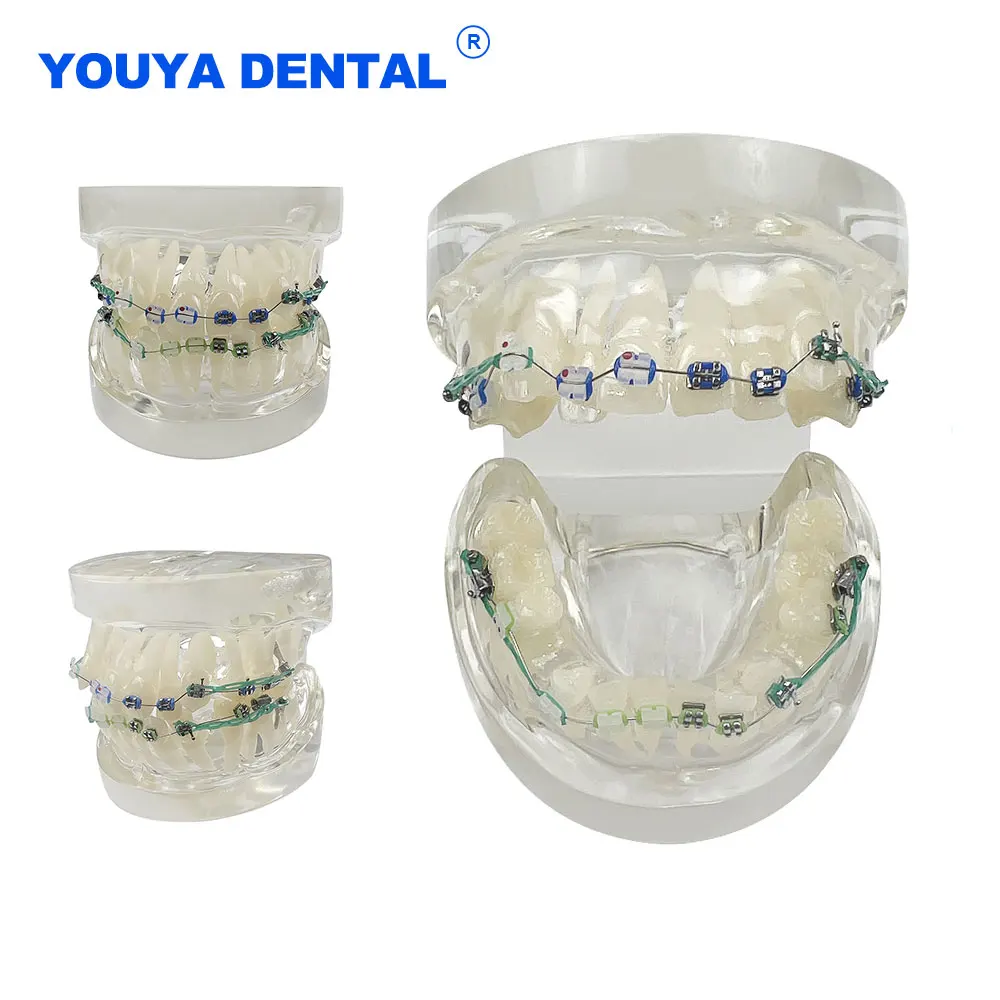 Orthodontic Teaching Model Dental Standard Teeth Model Metal / Ceramic Brackets for Patient Communication Dentistry Training Dem