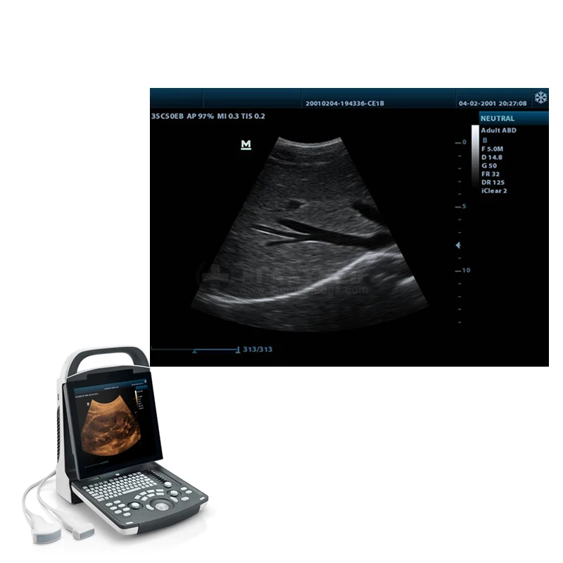 High Quality Medical Ultrasound Machine Mindray DP-20 Potable Digital Ultrasound Device for Abdomen, OB, GYN, Cardiology