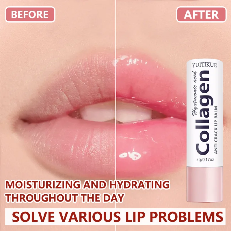 YUITIKUE Moisturizing Collagen Lip Balm, With Hyaluronic Acid, Delivers Long-Lasting Hydration for Smooth, Plump Lips