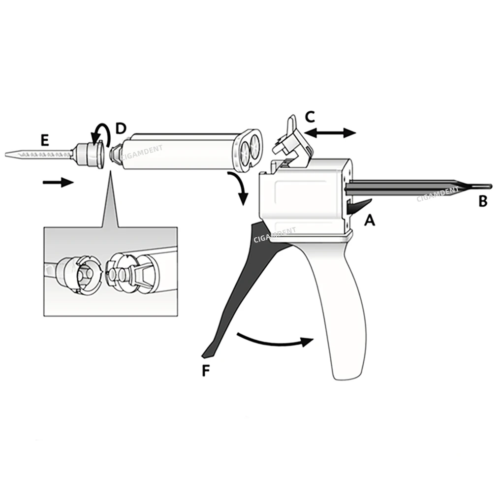 DMG Luxatemp Automix Plus Dental Temporary Crown Bridge Material A2 Shade Mixing Tips Impression Dispensing Mixing Gun 10:1