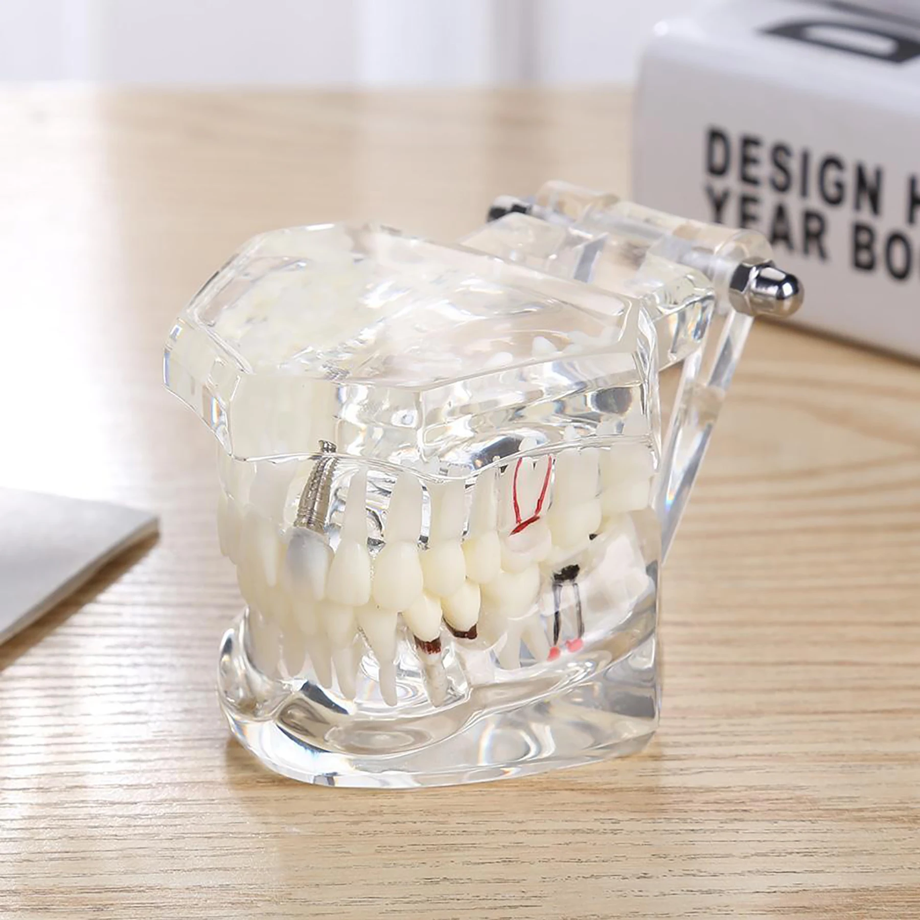 Dental Teeth Teaching Model Variety standard/Orthodontic/Implant/Pathological/Periodontal/Restoration/practice Model