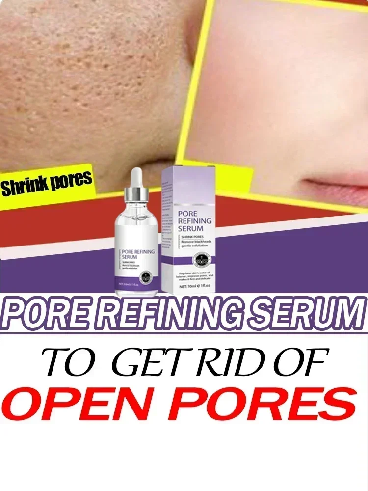 การขจัดรูขุมขนขนาดใหญ่บนใบหน้า Pore Rinning Resurfacing เซรั่มหดตัวรูขุมขนอันทรงพลังเพื่อการกระชับ