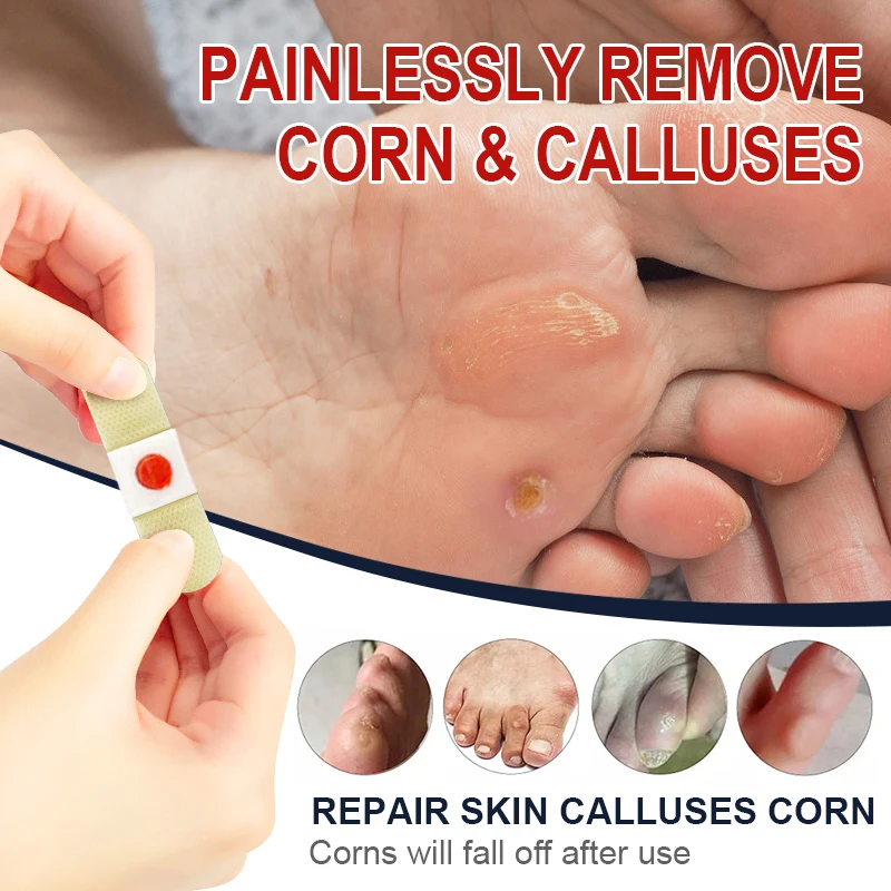 18pcs Foot Corn Killer Plaster Calluses Medical Sticker Toe Protector Reduce Friction Dressing Plantar For Feet Wart Plaster