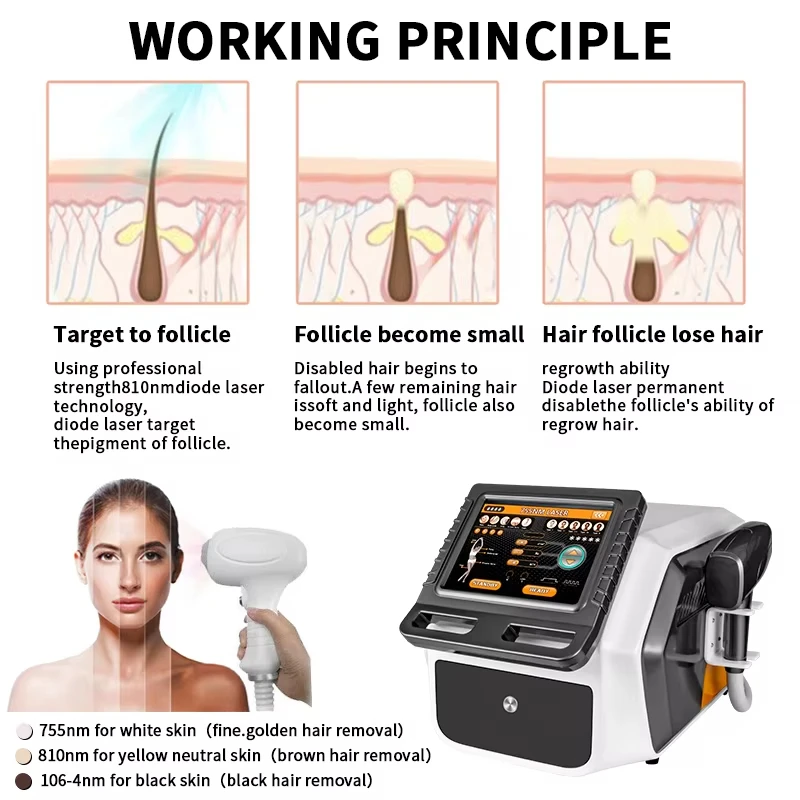 Portable 3 wavelengths diode laser hair removal machine with 755 810 1064nm diode laser