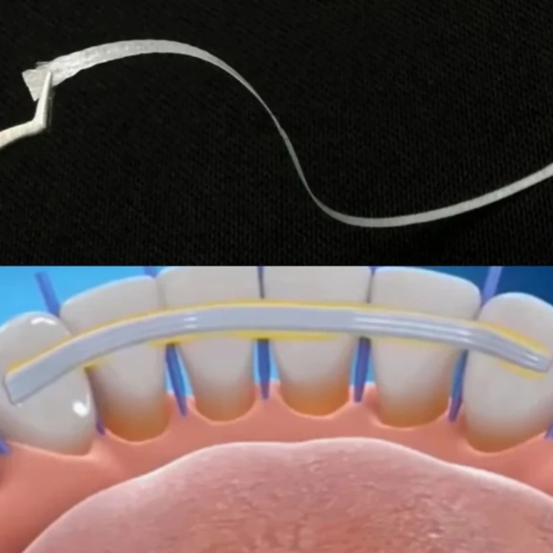 1 szt. Materiał dentystyczny elastyczny pasek z włókna szklana szyna luźne paski mocujące zęby lekkie utwardzanie klejenie ortodontyczne elementy ustalające