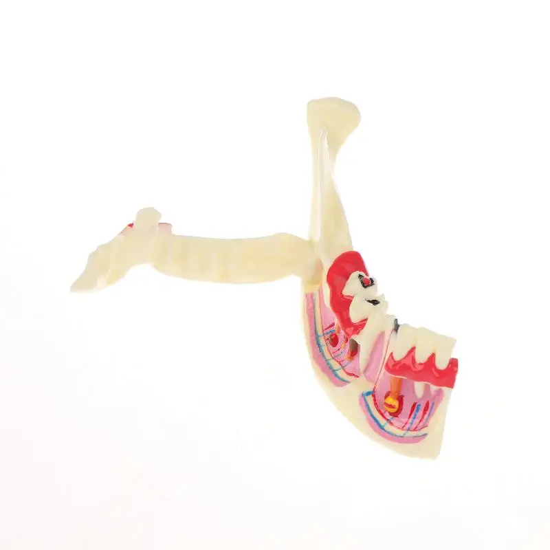 Modelo anatômico de tratamento endodôntico dental, tecido mandíbula de goma para dentista, ensino, estudo, modelo de dentes de demonstração