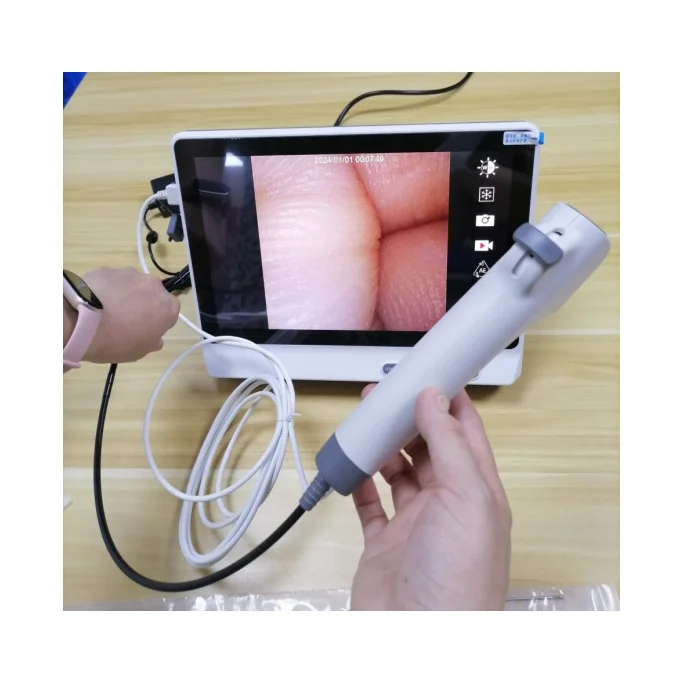 High Quality Disposable ENT Endoscopy Urology Flexible Bronchoscope Endoscope System with Touch Screen