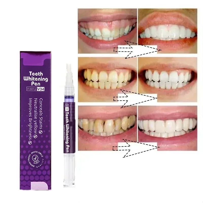 Teeth Whitening Pen Tooth Gel Whitener Bleach Remove Plaque Stains Teeth Cleaning Essence Gel Toothpaste Brighten Teeth