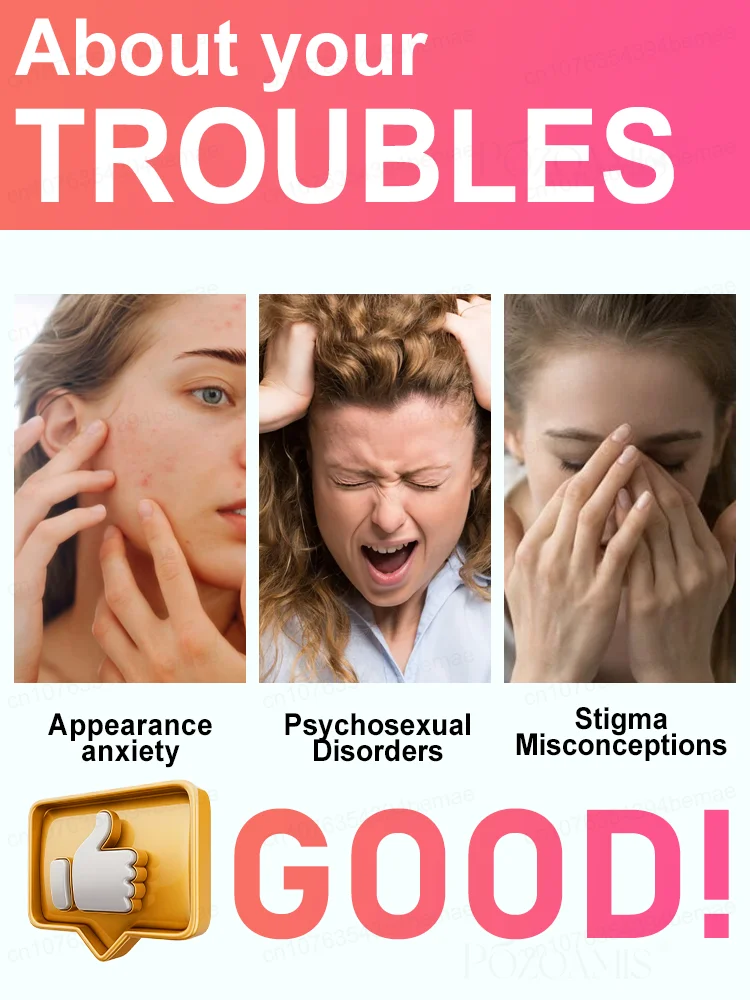 ʙʟᴜᴇ ʟɪɢʜᴛ ᴘᴇɴ sᴏʟᴠᴇ ᴡᴀʀᴛs, ʜᴏᴛ sᴀʟᴇ ᴡᴀʀᴛ ᴄᴀʀᴇ ᴛᴏᴏʟs