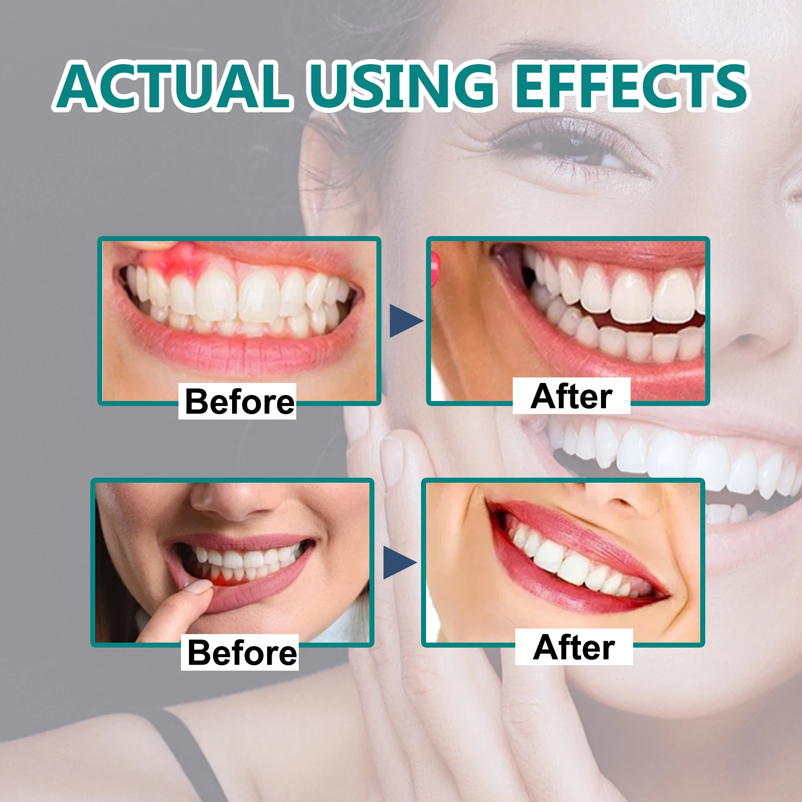 Gingival repair drops Quickly Repair of Cavities Caries Teeth Whiten Remove Yellow Plaque Stains Relieve Gums Decay Toothpaste image 3