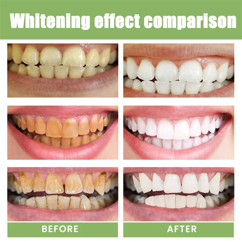 5 Day Teeth Whitening Powder Remove Plaque Stains Toothpaste Deep Cleaning Fresh Breath Oral Hygiene Dentally Tools Teeth Care