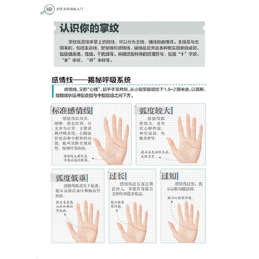 Quick Introduction to Hand Diagnosis and Therapy Hand Traditional Chinese Medical Science Book