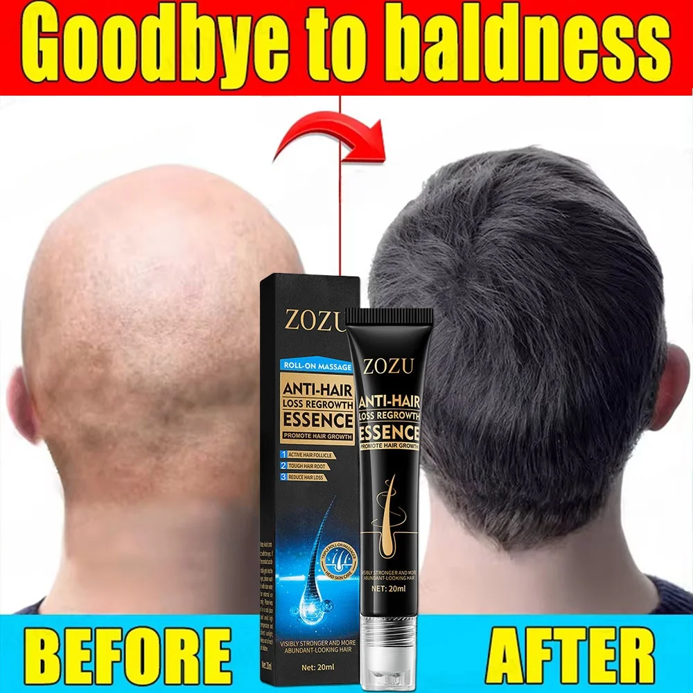 

Fast Hair Growth Essences Anti Hair Loss Serum Baldness Repair Hereditary Postpartum Seborrheic Hair Care Products For Men Women