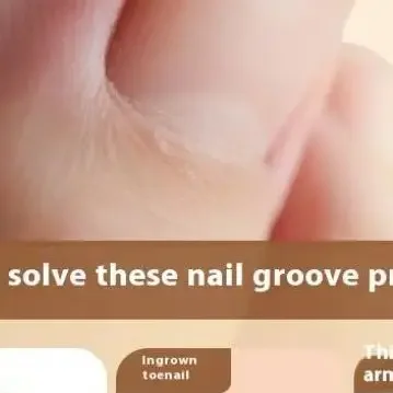 Cortauñas para uñas gruesas para personas mayores con hoja Diagonal curvada para uñas encarnadas, sin esfuerzo