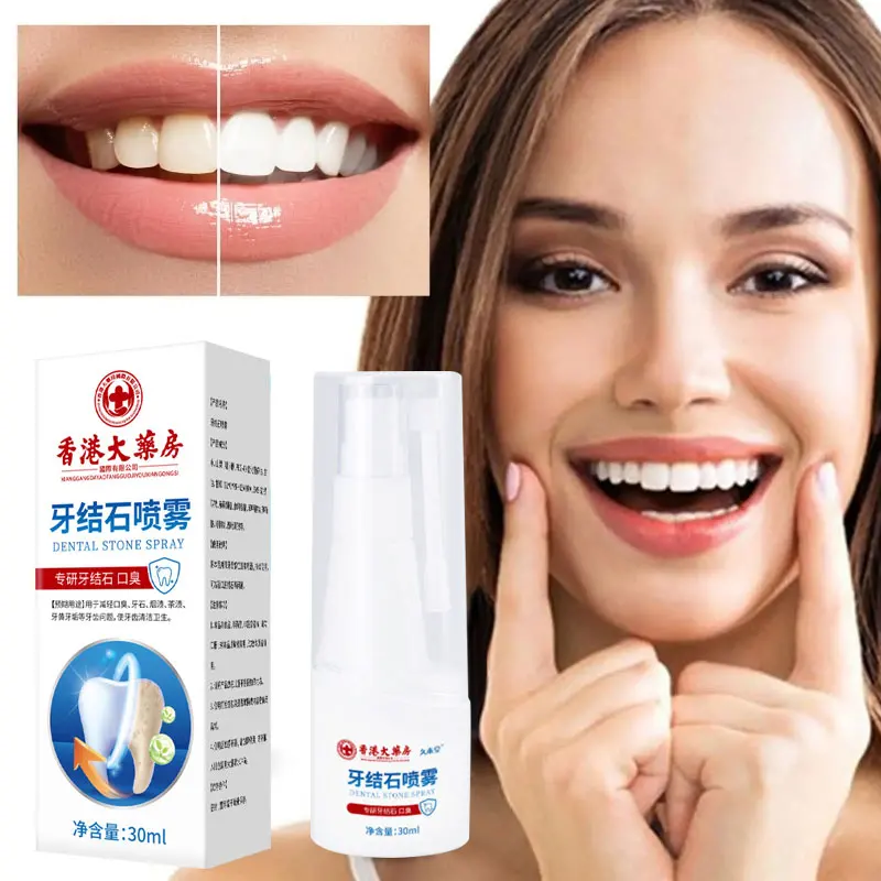 Spray para blanquear los dientes, removedor de cálculo Dental, limpieza de pasta de dientes, higiene bucal, eliminación de manchas de placa de halinosis, aliento fresco, cuidado