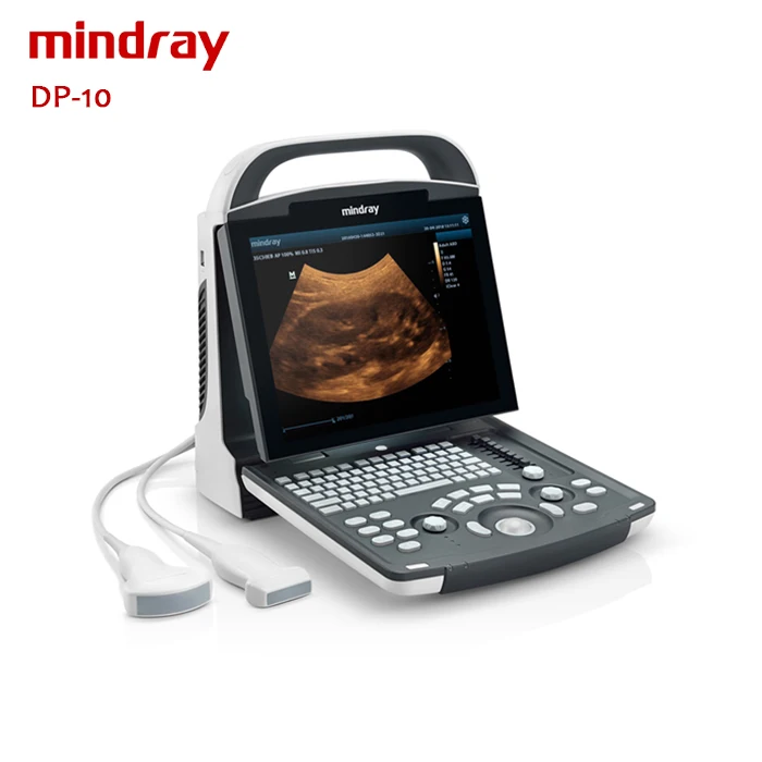 Mindray ultrasound dp 10 cheaper price Medical Ultrasound Instruments for hospital use