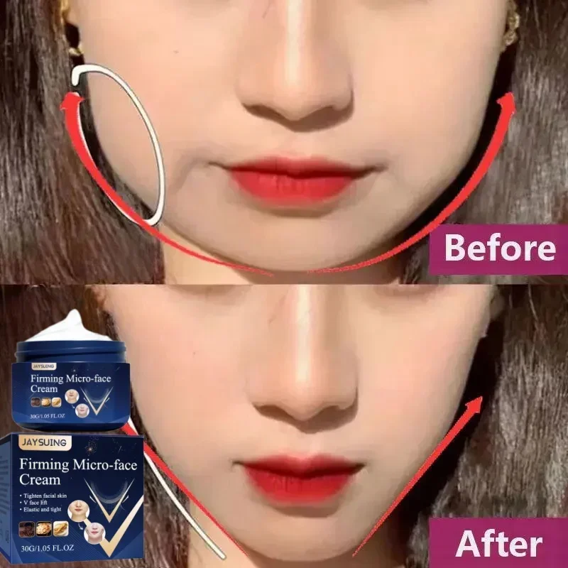 

V-Shape Face Slimming Cream Lift Up Firming Tighten Line Masseter Face Muscle Fat Burning Cream Reshaped Face Counter Skin Care